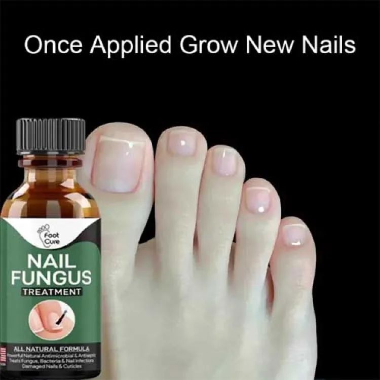 Nail Fungus Treatment Stop Fungal Growth Effective Fingernail 10ml - Image 3